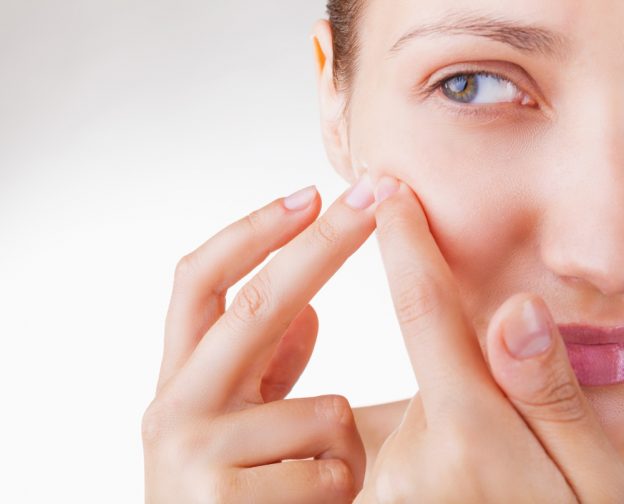 What Causes Us to Have Acne and Pimples?