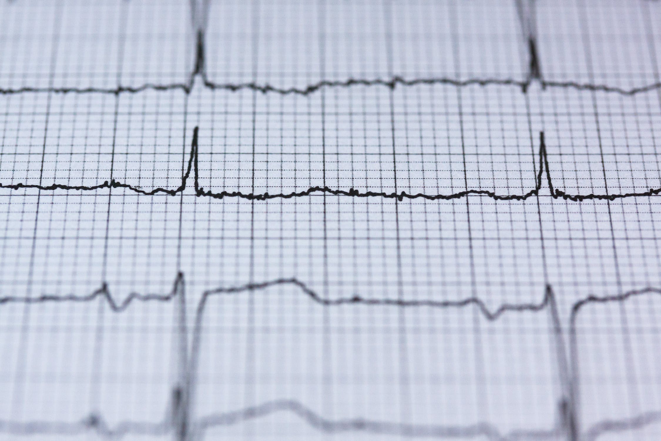 heartbeat graph 
